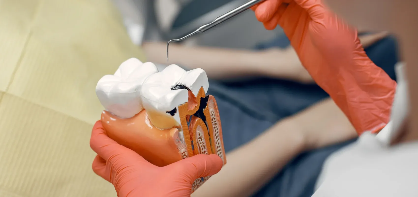 Dentistes Montigny-en-Gohelle Traitement des caries